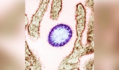 Аса қауіпті вирус дүниені дүр сілкіндірді