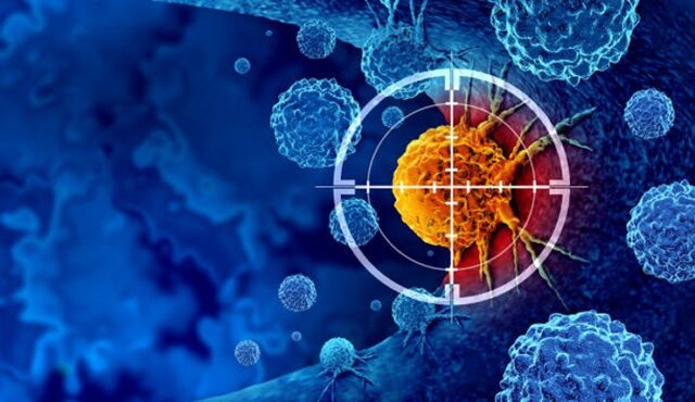 Әрбір сегізінші обыр инфекциямен байланысты Әрбір сегізінші обыр инфекциямен байланысты